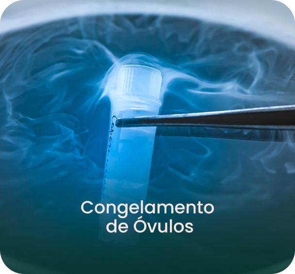 Congelamneto de Ovulos2