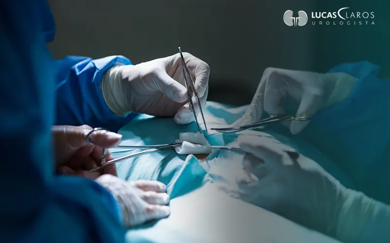 Como é feita a cirurgia de vasectomia? Conheça os detalhes 